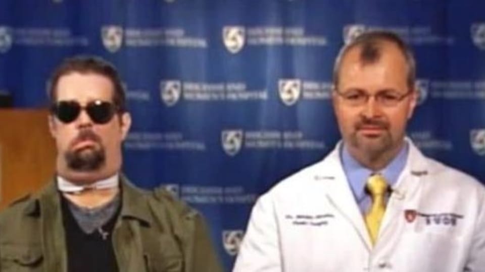 Bohdan Pomahač a jeho pacient Dallas Wiens, který podstoupil transplantaci obličeje Bohdan Pomahač a jeho pacient Dallas Wiens, který podstoupil transplantaci obličeje